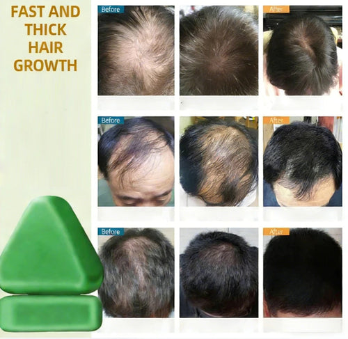 NATURE Botanical Hair & Scalp Care Bar
